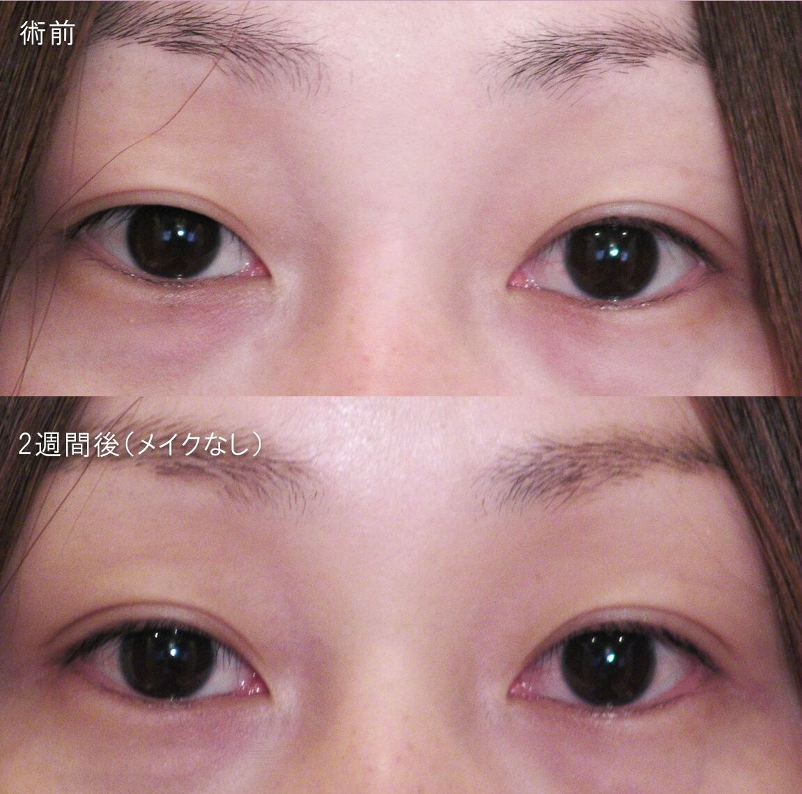 LS法ダブル (ロングプラン)右側のみ