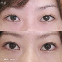 画像4576：LS法ダブル (ロングプラン)